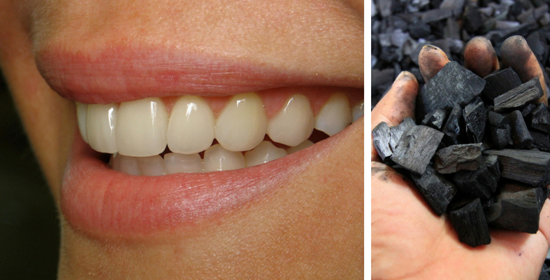 Hentikan Ubat Gigi Arang SEGERA, Ini Sebab Kukuh Kenapa Pakar Gigi Larang Penggunaanya! 