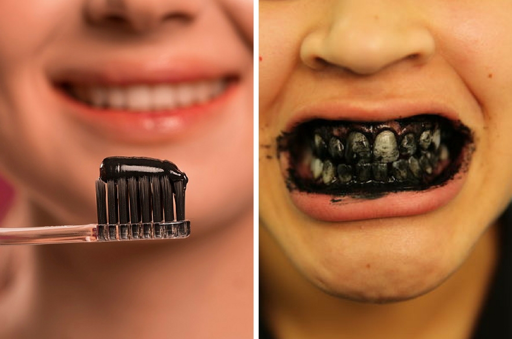 Hentikan Ubat Gigi Arang SEGERA, Ini Sebab Kukuh Kenapa 